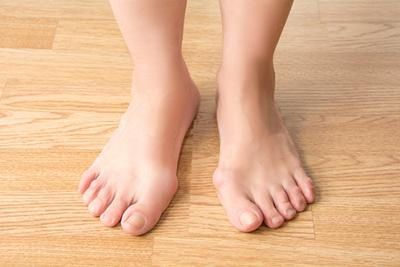 What Parents Should Watch for to Prevent Bunions in Children Prevent Bunions in Children