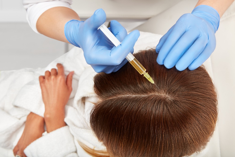 What To Expect During a PRP Hair Loss Session PRP Hair Loss Session