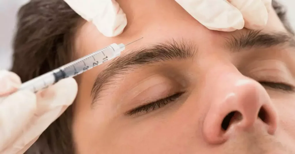 Botox for Migraines